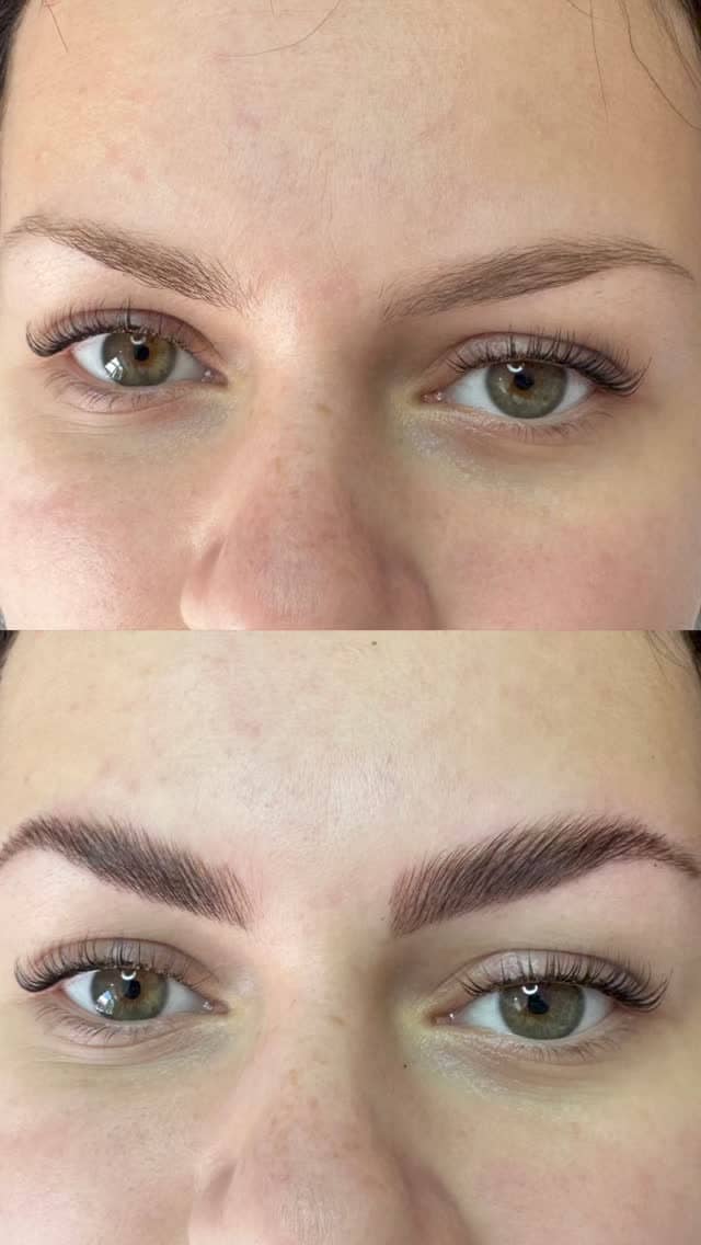 Obrve pre i posle brow lift tretmana
