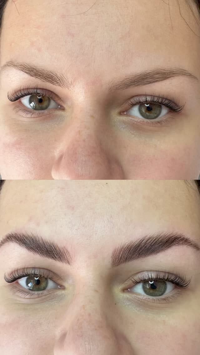 Obrve pre i posle brow lift tretmana
